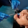 FAQs related to cosmetic dentistry that you should know