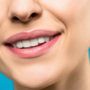 Importance of Teeth Whitening & How Can South Bay Help You With It