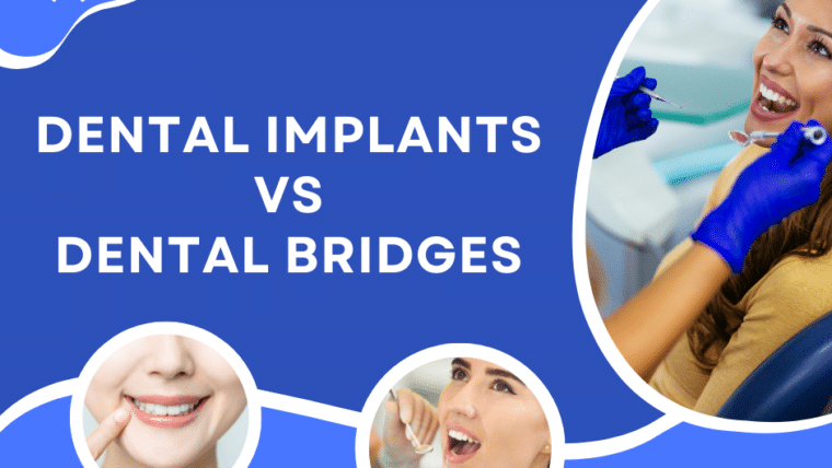 Dental Implants vs. Dental Bridges: Which is Better?