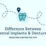 Dentures Vs Dental Implants: Which One Is Better For You