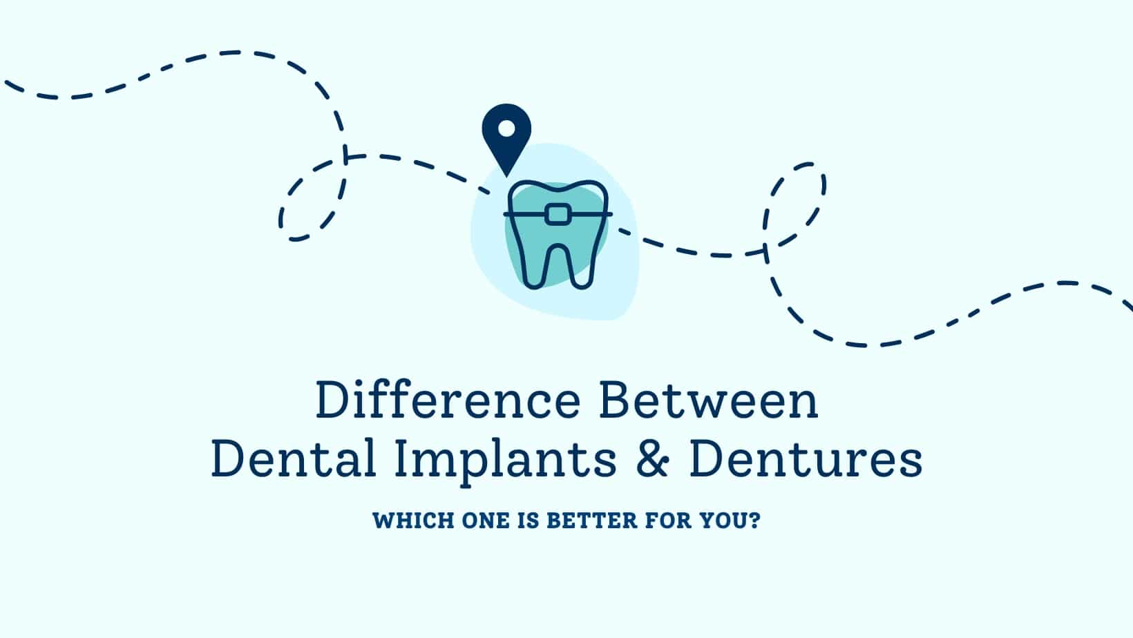Difference between dental implants and dentures