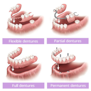 Dentures to fit your needs by South Bay Dentistry and Orthodontics