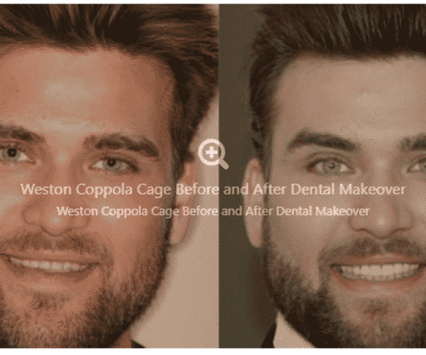 South Bay Dental & Orthodontics – Before and After Gallery